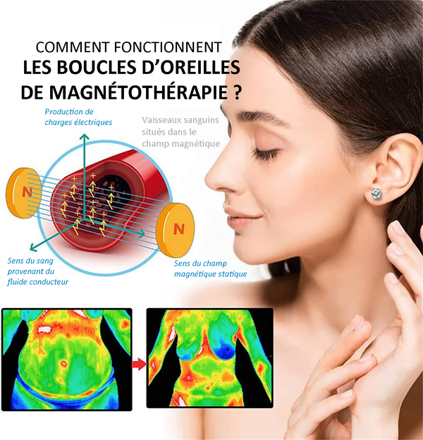 Boucles d'oreilles de magnétothérapie